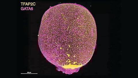 successful-creation-of-human-womb-sac-in-lab