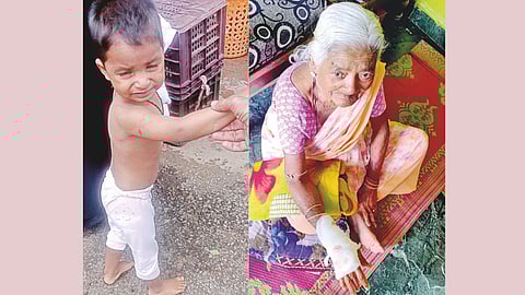 Nipani Stray Dog Menace