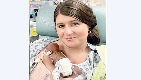 US Boy Born At Just 21 Weeks Sets Guinness World Record For "Most Premature Baby