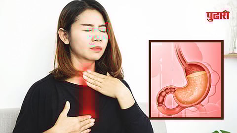 Fasting acidity remedies