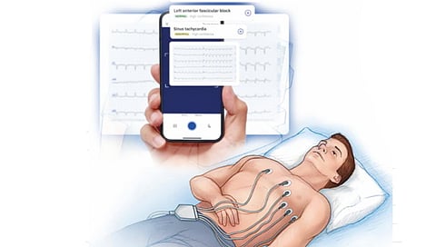 heart-disease-diagnosis-through- AI