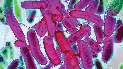 viruses-to-kill-bacteria-phage-therapy