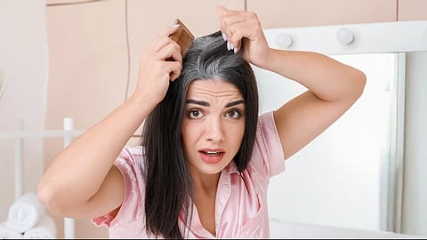 White Hair Home Remedies: Has your hair turned white? Make it black at home, that too easily..