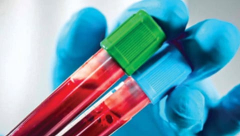 rare-crib-antigen-blood-group-found-in-karnataka