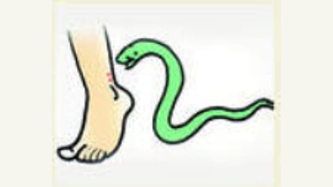 Rise in snakebite cases