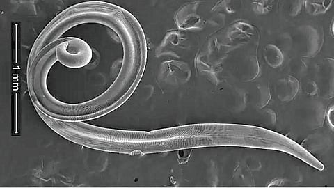 Felt like something was poking me in the eye, four live worms came out!