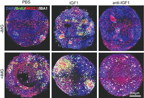 brain-immune-cells-boost-neuron-formation