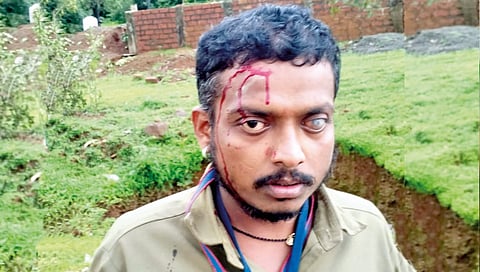 Gazapur: Tax Collection Employee Brutally Beaten During Duty