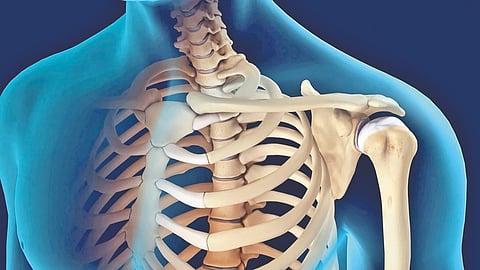 reverse-total-shoulder-replacement-surgery-explained