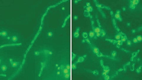 Fungal infection treatment