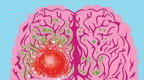 Brain Cancer Treatment