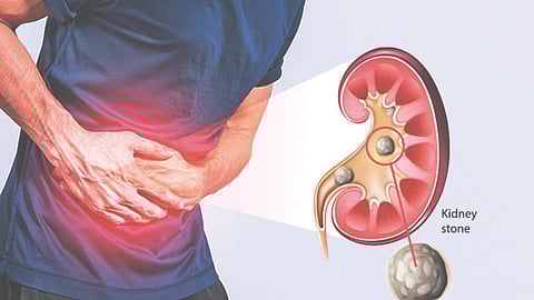 Urinary Problems In Winter