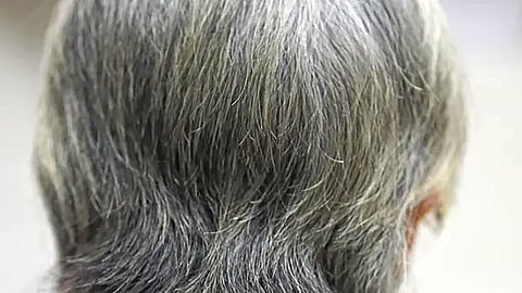 greying-hair-indicates-body-protection-from-cancer