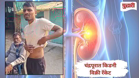 Chandrapur kidney Racket |