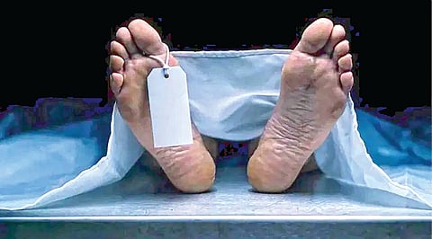 human organ alive after death