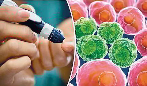 Diabetes and Cancer Link