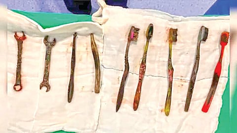 Shocking medical case