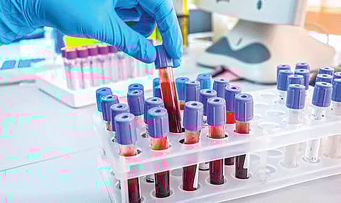 Prostate cancer treatment