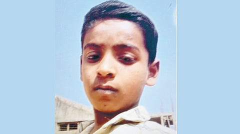 Kite flying accident