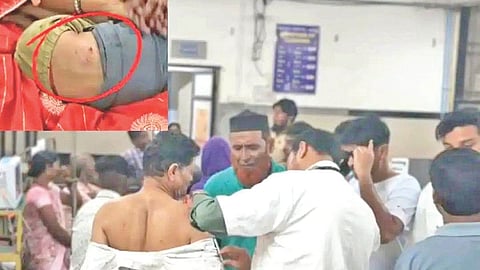 Rabid dog attack voters Jalna