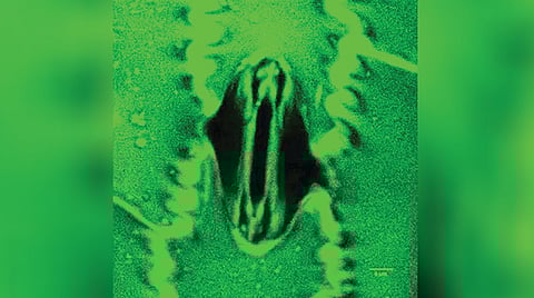 Plant Respiration Technology