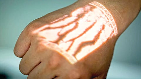 Painless injection technology |