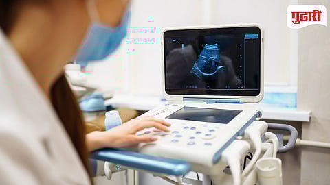 sonography machine
