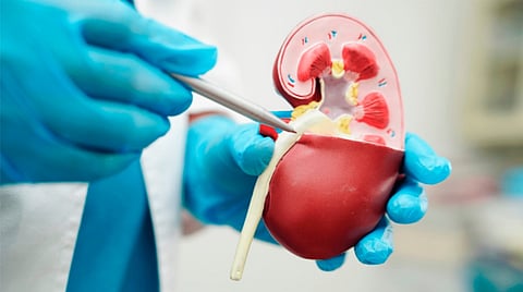Universal kidney transplant |