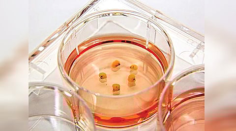 Lab Grown Human Mini Brain