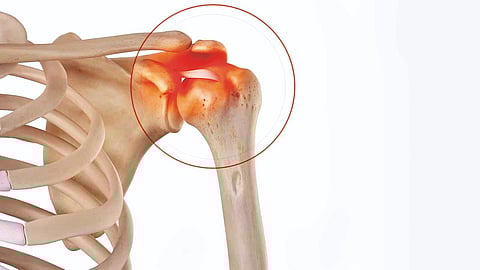 Shoulder Pain Problem