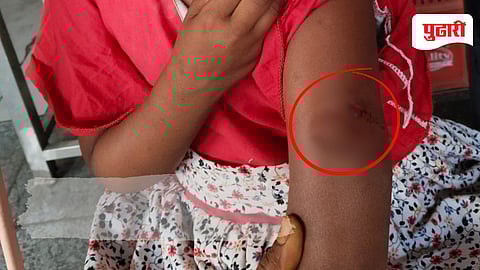 Monkey terror in Nanded| धर्माबादमधील साईनगर, शंकरगंजमध्ये माकडांची दहशत