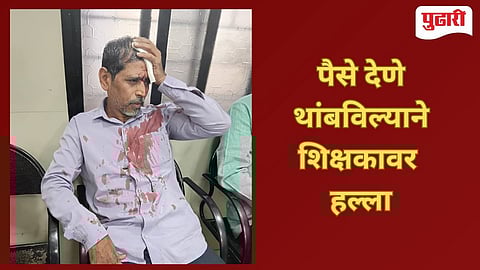 Nagpur Crime | दरमहा 30 हजार देणे थांबवले,शिक्षकावर प्राणघातक हल्ला!