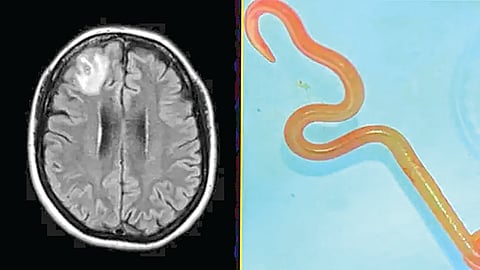 Woman Brain 3 Inch Worm |