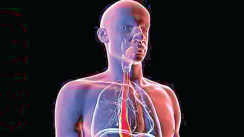 Digital clone surgery