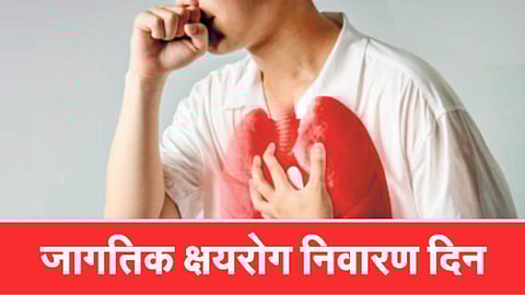 Tuberculosis Cases |