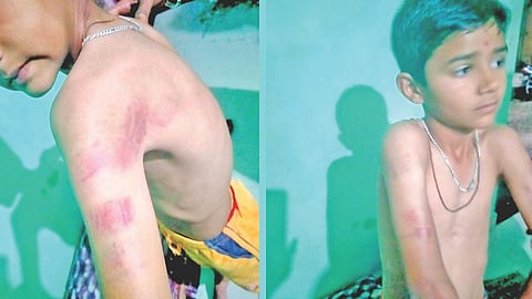 Partur teacher assault case