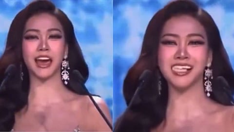 model fake teeth slipped