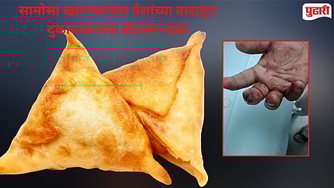 samosa payment dispute Mumbai.