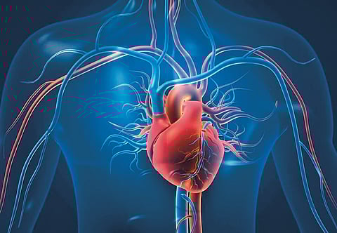 Heart Attack and Bypass Surgery |