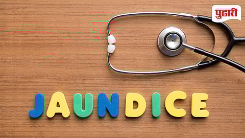 Newborn Jaundice Test