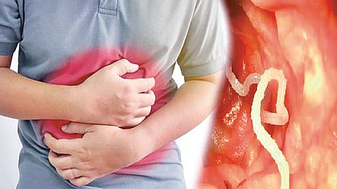 Stomach worms treatment |