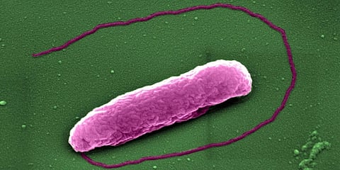 bacteria