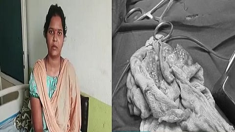 அறுவை சிகிச்சை பிரசவம்