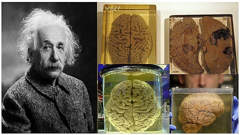 Albert Einstein, Brain