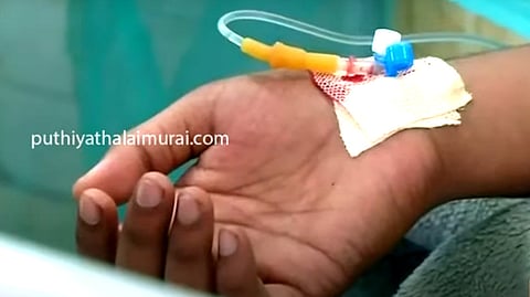 சிகிச்சை