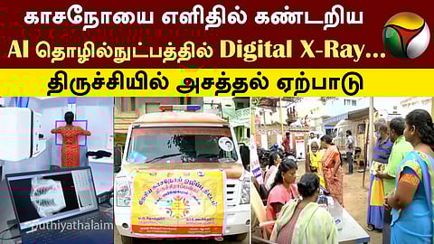 காசநோய் டிஜிட்டல் X-Ray.