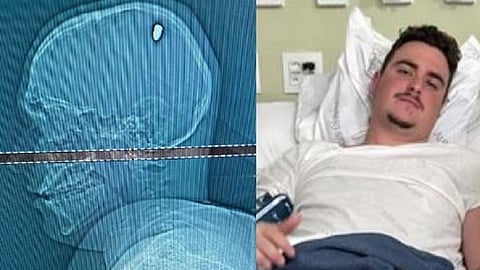 பிரேசில் இளைஞர்