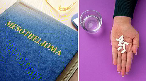 மீசோதெலியோமா - மருத்து