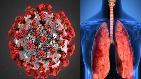 நுரையீரல் குறைப்பாடு