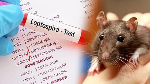 எலிகாய்ச்சல்